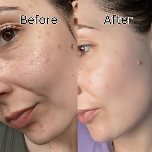 Anua Niacinamide 10% TXA 4% Dark Spot Removing Serum 30ml - Avoriell