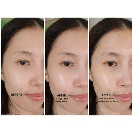Anua 7 Rice Ceramide Hydrating Barrier Serum 50 ml