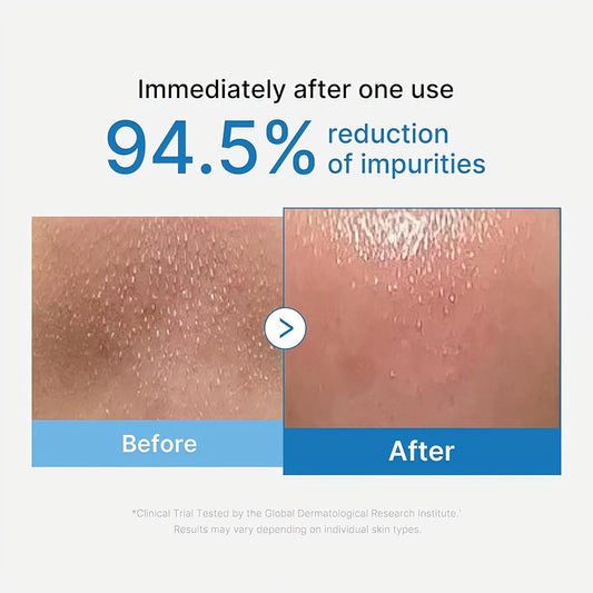 Medicube Zero Pore Blackhead Deep Cleansing Oil 205ml - Avoriell