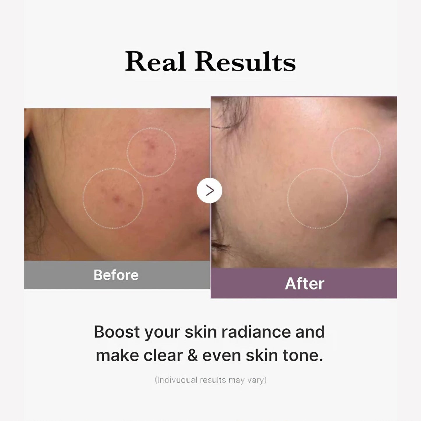 Medicube Age - R Glutathione Glow Serum 30g - Avoriell