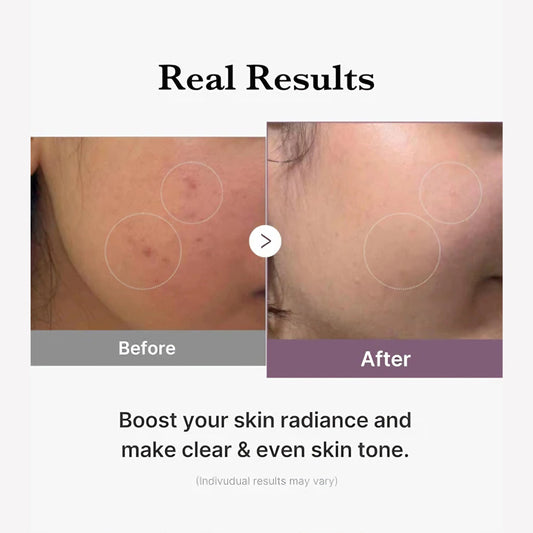 Medicube Age - R Glutathione Glow Serum 30g - Avoriell
