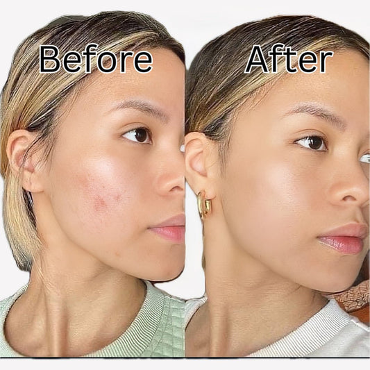 La Roche Posay Effaclar Ultra Concentre Serum 30ml - Avoriell