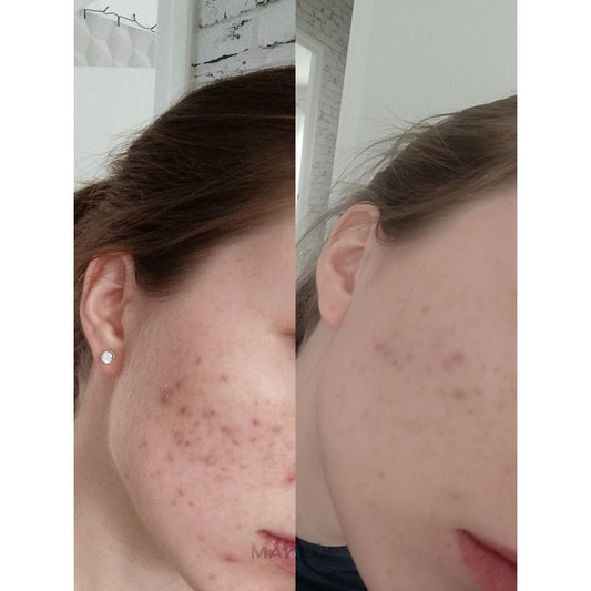 La Roche Posay Cicaplast Balm B5+ 100ml - Avoriell