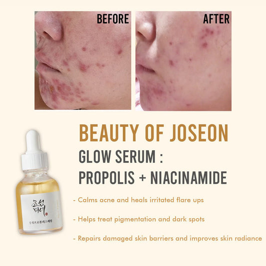 Beauty of Joseon Propolis + Niacinamide Glow Serum 30ml - Avoriell