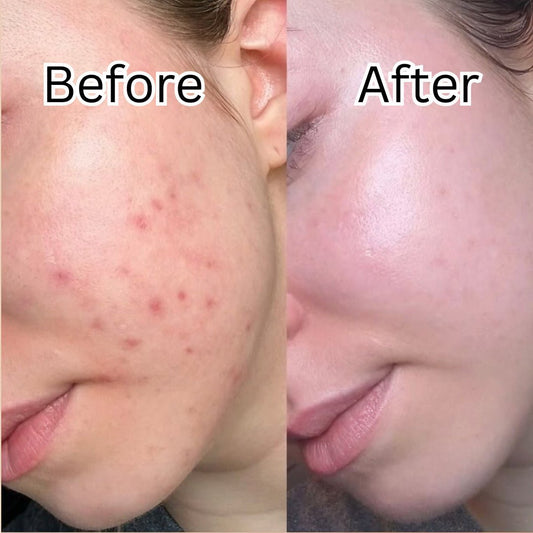 Dr. Althea 345 Relief Cream Mist 60 ml - Avoriell