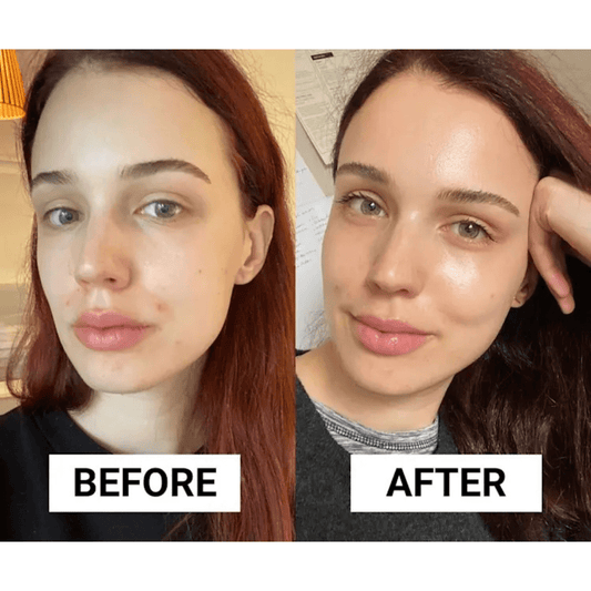 La Roche Posay Effaclar Duo + M 40ml - Avoriell